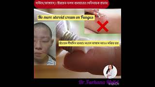 NoSteroidscreamonFungus দাউদ steroid cream skin tinea dermatology skintreatment [upl. by Anaibaf507]