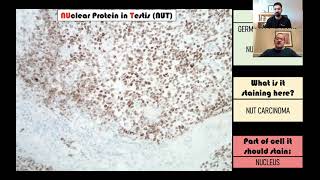 Immunohistochemistry in Pathology [upl. by Lenny]