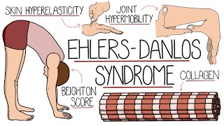 Ehlers Danlos Syndrome Explained Clearly [upl. by Kahl]