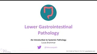 Lower Gastrointestinal GI Pathology  Introduction to Systemic Pathology [upl. by Ynamreg]