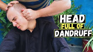 Dandruff Head Heavy Oily Head Massage ASMR To Relief Headache Neck amp Head Massage [upl. by Ryder]