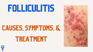 FOLLICULITIS Causes Symptoms amp Treatments [upl. by Aitnas]