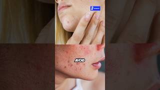 இந்த Foods லாம் சாப்பிட்டா Acne வருமா doctobooks facecare acne [upl. by Balduin]