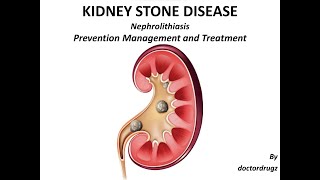 KIDNEY STONES TREATMENT kidney health liver diet diabetes edema infection drink water pain [upl. by Rekab463]