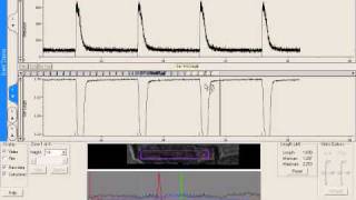 Ca oscillations and contractions of adult cardiac myocytes [upl. by Enilra883]