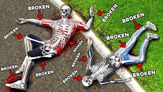 We Broke EVERY BONE in GTA 5 RP Mods [upl. by Acirfa]