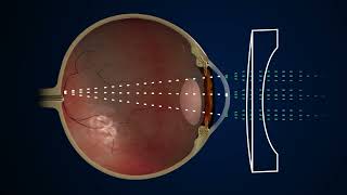 Novel Ophthalmic Analyzer  2024 [upl. by Nabroc]