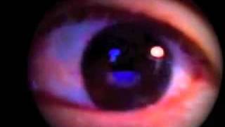 Fase REM  Rapid Eyes Movements [upl. by Cahilly]