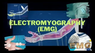 Electromyography  Electromyograph  Electromyogram  EMG  EMG Test  EMG Procedure [upl. by Yenaj247]