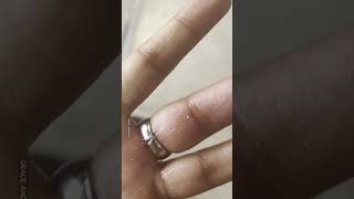 Girl Gets Ring Stuck On Finger 😱💍 [upl. by Asseniv]