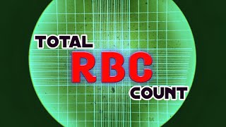 Red Blood Cell Count Test  Total RBC count  Procedure and Calculations [upl. by Zannini322]