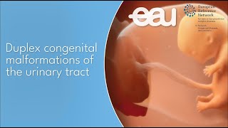 Duplex Congenital Malformations [upl. by Cirad]