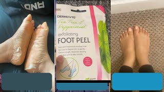 I Tried a foot peel mask Dermav10 foot peel…I cant believe the results [upl. by Ecadnac8]