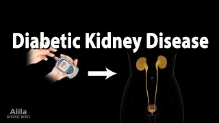 Diabetic Kidney Disease Animation [upl. by Kerekes]