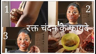 रक्त चन्दन के फायदे । How to  Red Sandalwood Powder face mask for Acne Prone skin [upl. by Atinra557]