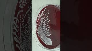 Growth Character of Staphylococcus hominis on Blood Agar Colony Morphology and Diagnostic Insights [upl. by Ynhoj510]