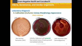 Vibrio Aeromonas and Similar Organisms [upl. by Edie474]