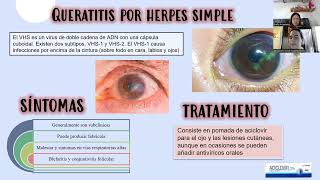 Principales patologías de la superficie ocular y cornea [upl. by Eadie]