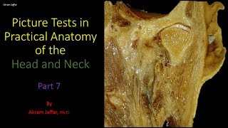 Picture tests in head and neck anatomy 7 [upl. by Soinotna773]