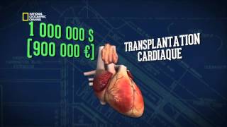 A combien évaluer vous une transplantation d’un organe [upl. by Assyral]