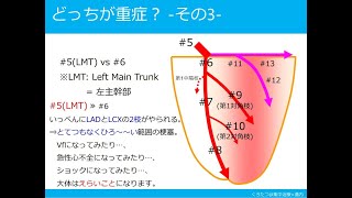 【心カテ】冠動脈の解剖とシネ画像 第３話 冠動脈の解剖から考える重症度について [upl. by Annas933]