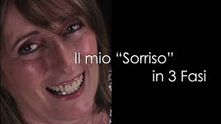 Il mio Sorriso in 3 fasi [upl. by Freedman]