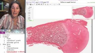 Popular Classic F13 Endochondral ossification [upl. by Celeski335]