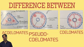 Acoelomates Pseudocoelomates and coelomates  Triploblastic organisation [upl. by Mignon]