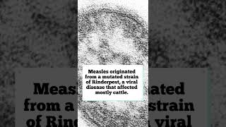 Facts about Measles trivia didyouknow disease healthcare [upl. by Moulton644]