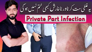 Jock Itch Treatment  Tinea Cruris  Private Part Itch  Babar Ali Hashmi [upl. by Gatias]