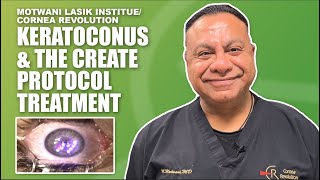 Keratoconus Treatment to Restore Vision Cornea Repair Epithelium and Topography Enhancement [upl. by Hermes]