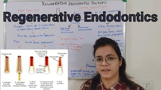 Regerative Endodontic Therapy  Revascularisation [upl. by Ennaeel534]