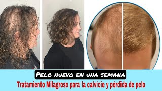 Esta mezcla RECUPERARÁ el cabello que perdiste😭 Cabello fino Calvicie y Crecimiento GARANTIZADO❗️ [upl. by Sikleb558]