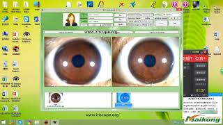 how to use the maikong iridology camera software for window 10 11 [upl. by Alonzo]