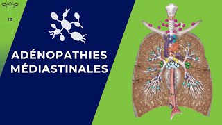 Adénopathies Médiastinales Rappel Anatomique  Diagnostique Positif  Etiologies  Traitement [upl. by Solorac651]