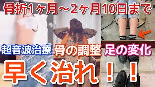 骨折から2ヶ月経過…足の太さが…！超音波治療と整体へ！変化は？？【骨折日記】 [upl. by Angelo]