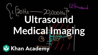 Ultrasound medical imaging  Mechanical waves and sound  Physics  Khan Academy [upl. by Zetnwahs]