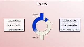 Intro to EKG Interpretation  Mechanisms of Tachyarrhythmias [upl. by Niwhsa]