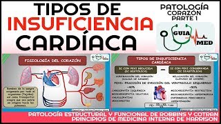 INSUFICIENCIA CARDÍACA DERECHA E IZQUIERDA FISIOPATOLOGÍA  GuiaMed [upl. by Arrej]