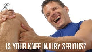 How to know if you have a serious knee injury [upl. by Atinahc902]