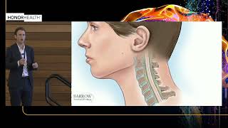 Cervical Myelopathy amp Radiculopathy  Core Knowledge for Management and Surgical Treatment [upl. by Gwynne]