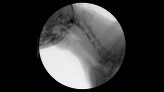 Canine mainstem bronchial and tracheal collapse fluoroscopy [upl. by Atalayah]