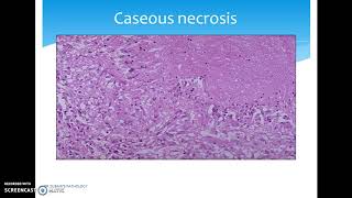 NECROSIS A TYPE OF CELL DEATH [upl. by Druce]