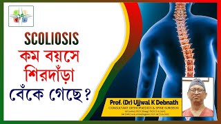 কম বয়েসে শিরদাঁড়া বেঁকে গেছে  Scoliosis  Dr Ujjwal K Debnath [upl. by Yenot]