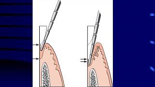 Fall 2020  Periodontology 1  Lec 1  Histology of the periodontium [upl. by Gnuhn]