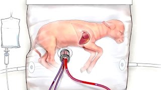 Un útero artificial mantiene con vida a fetos de animales prematuros [upl. by Vera]