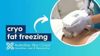 CryoDefine Fat Freezing  Australian Skin Clinics [upl. by Genet]