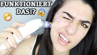 MITESSER SAUGER 😷 GEHT DAS 😱  Ebru Acikyol [upl. by Gwenny]