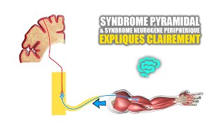 🔴 Syndrome pyramidal VS syndrome neurogène peripherique Expliqués Très Clairement par Dr Astuce [upl. by Kain]