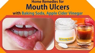 Home Remedies for Mouth Ulcers  Get Rid Mouth Ulcers with Baking Soda Apple Cider Vinegar [upl. by Ellerol]